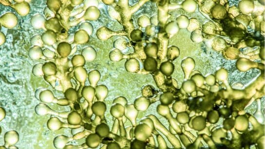 Diving Into the Potential of Microalgae for Human Health and Environmental Sustainability